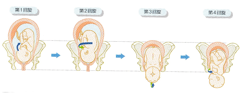 分娩時の産道拡大