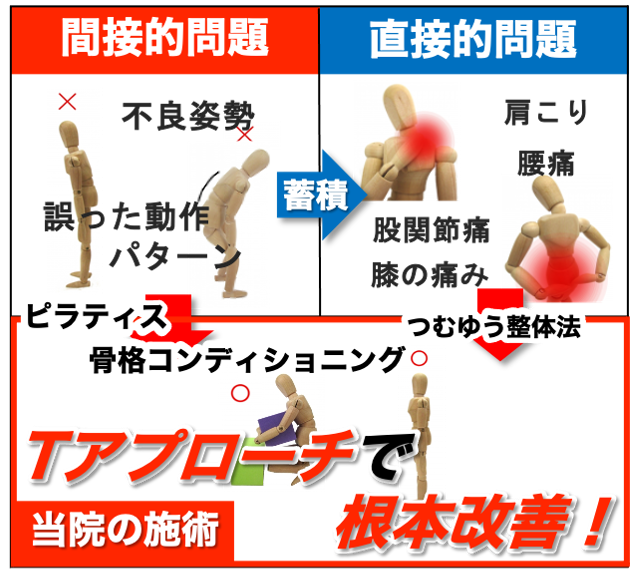 当院のTアプローチの詳細