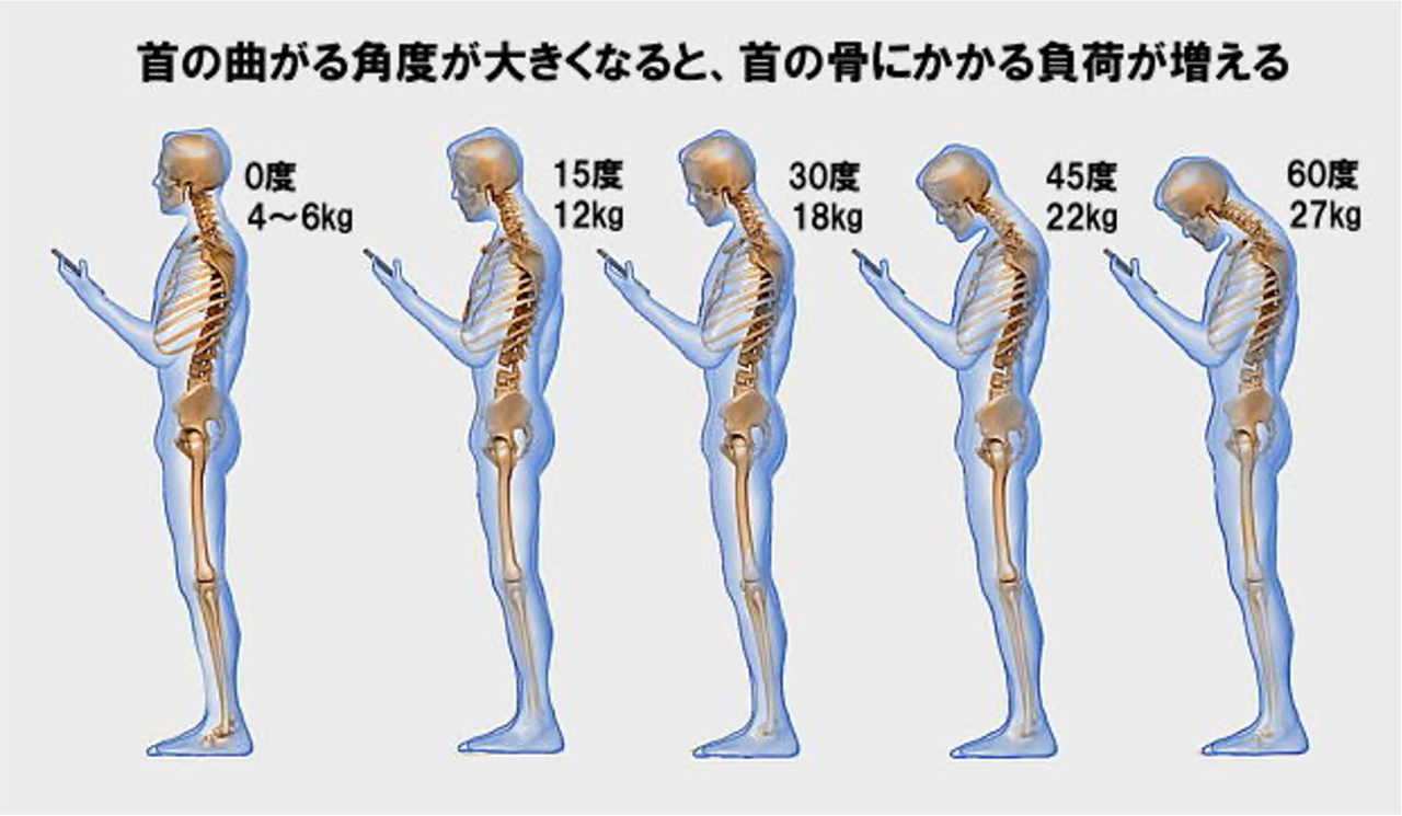 首の角度による頚部への負担