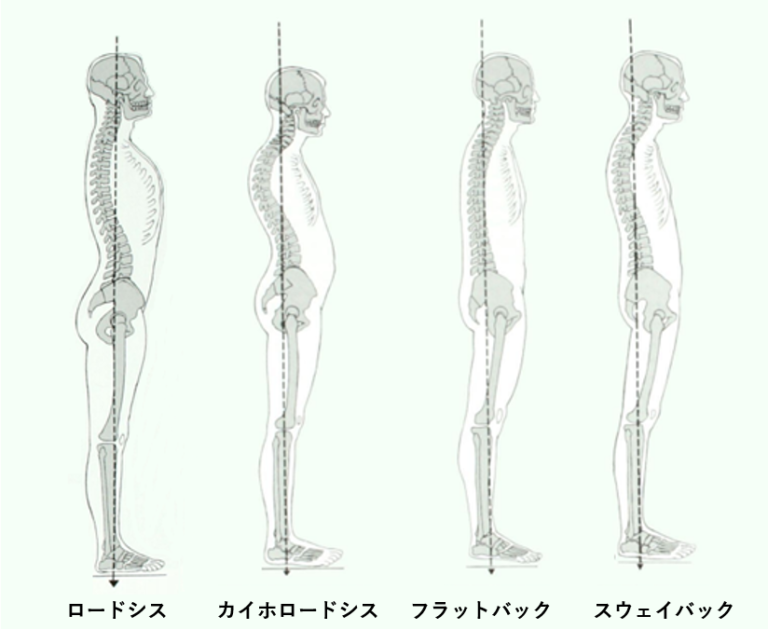 姿勢の問題