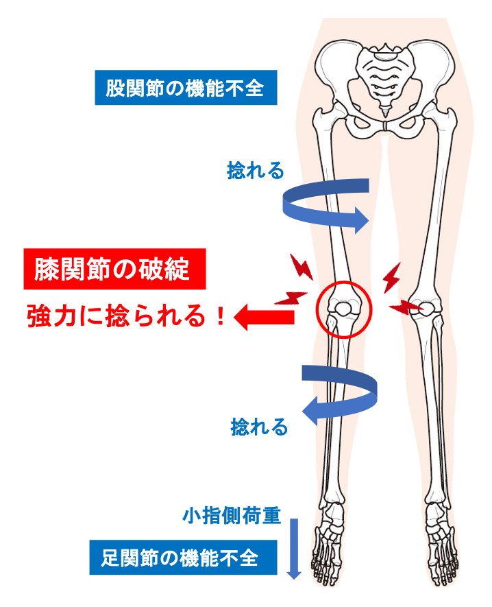 膝の痛みのメカニズム