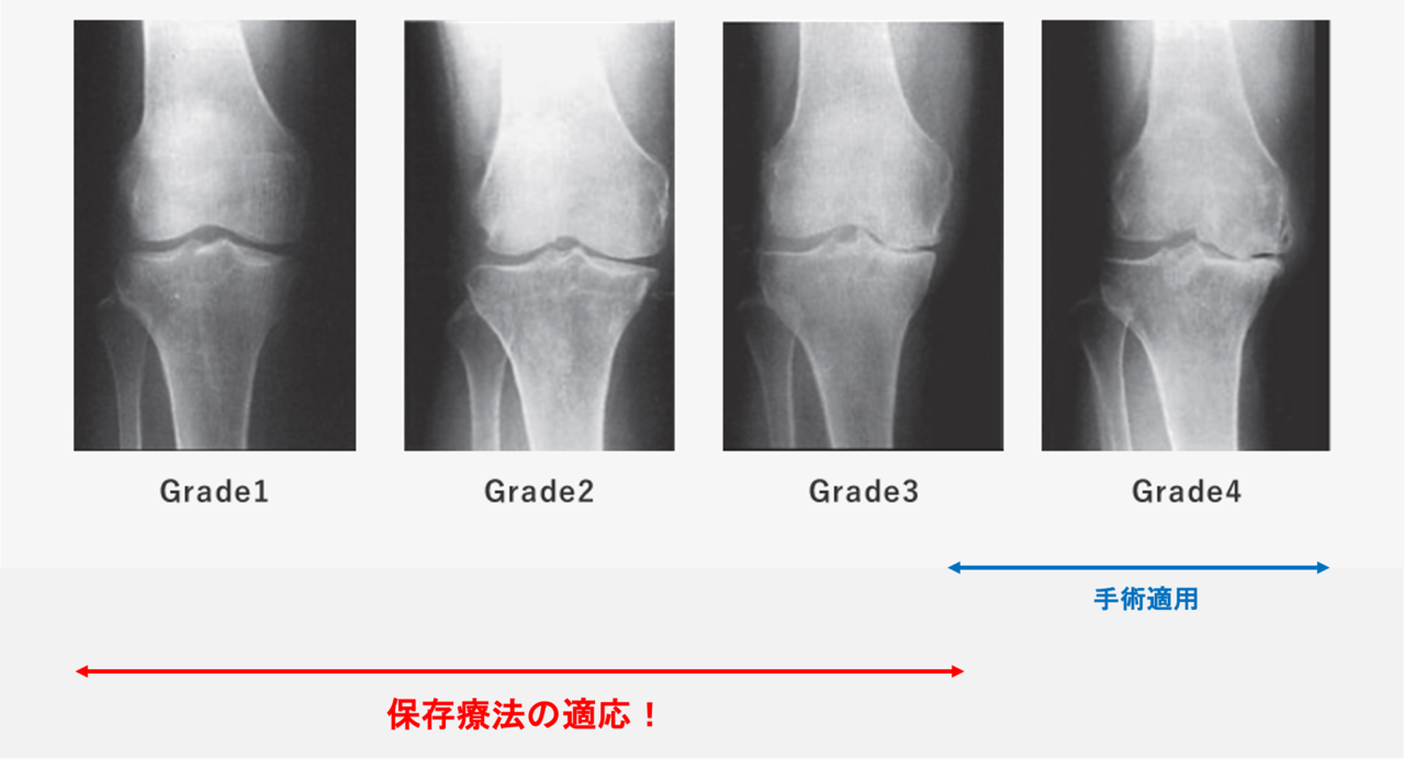 OAのグレード