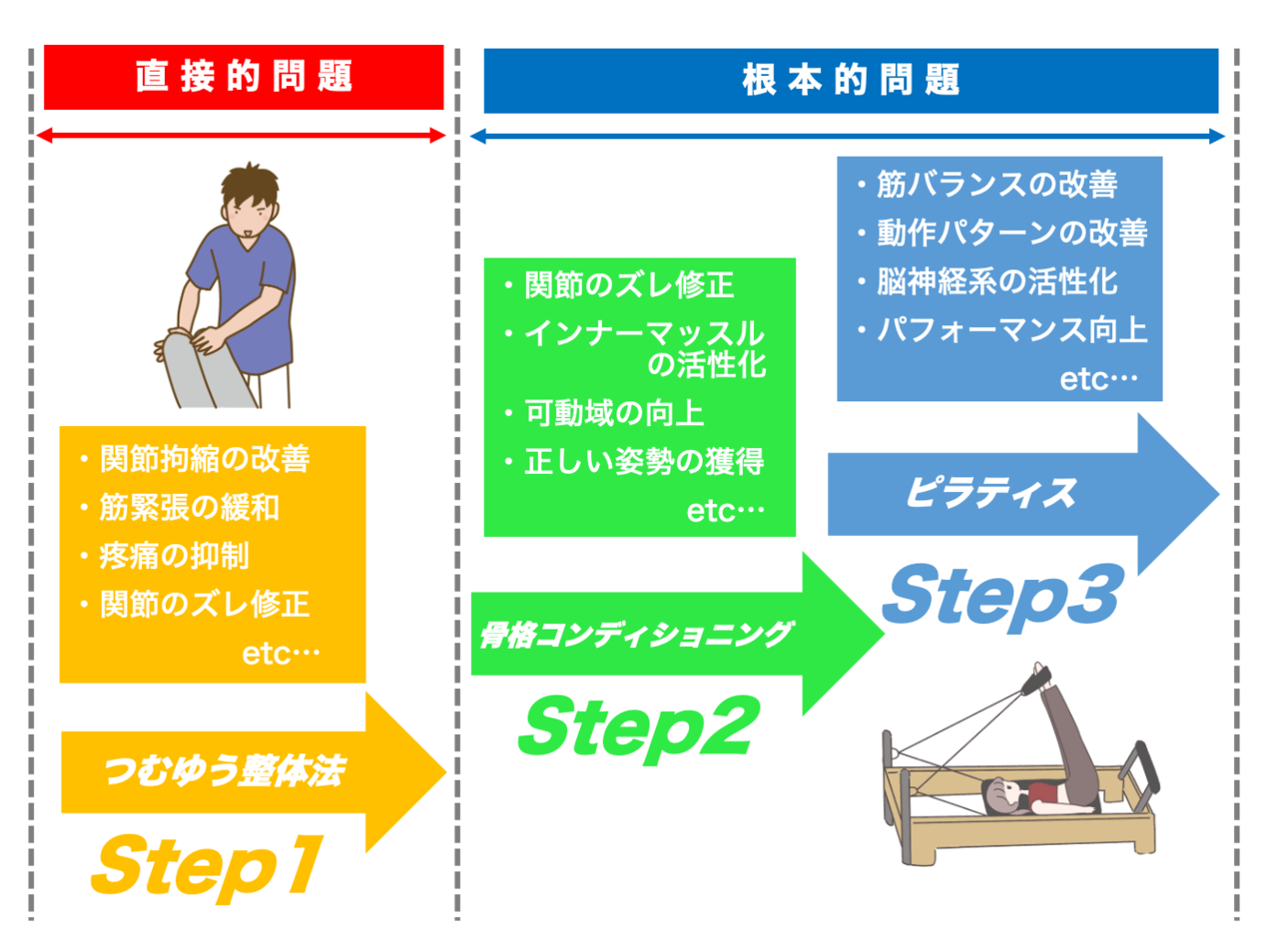 当院のWアプローチの詳細