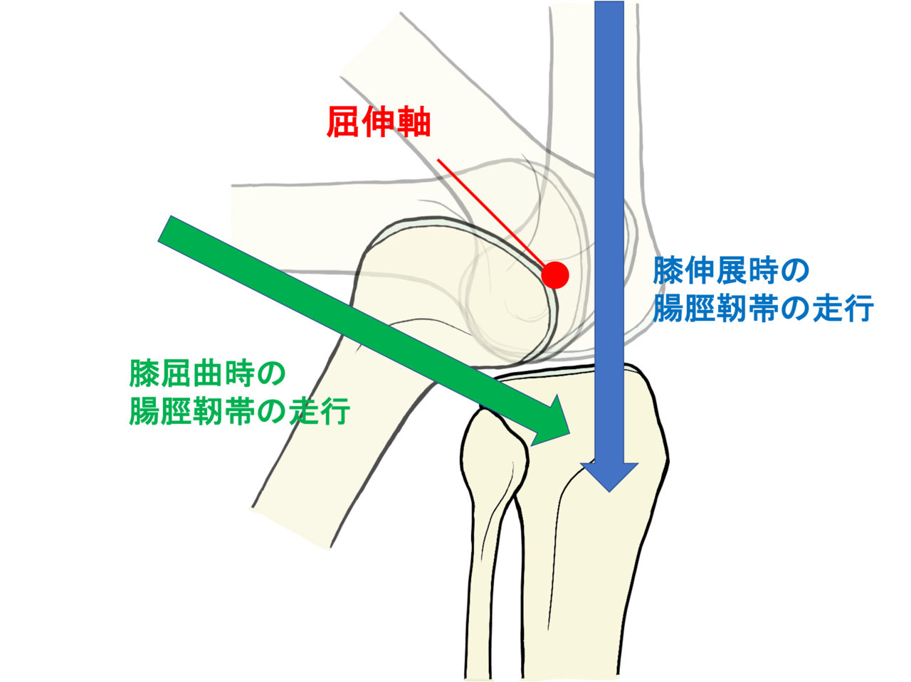 膝関節の角度による腸脛靭帯の走行