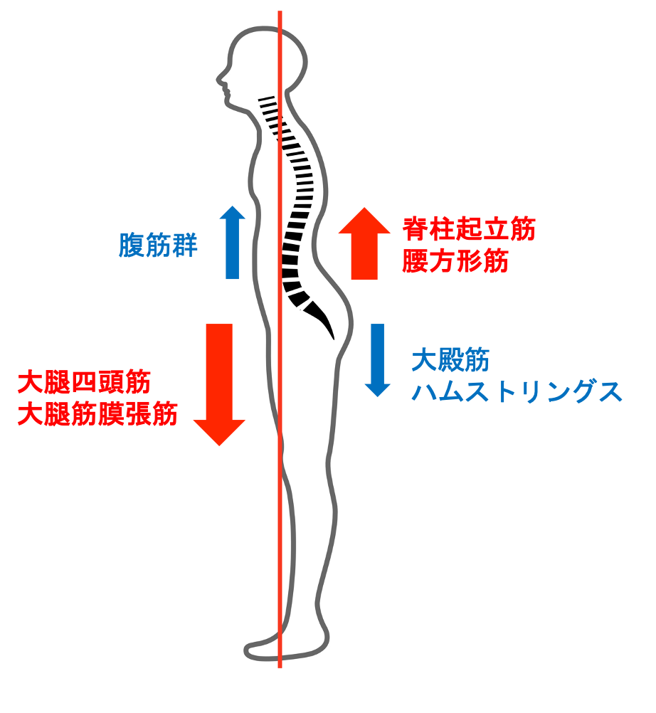骨盤前傾姿勢における筋肉のバランス