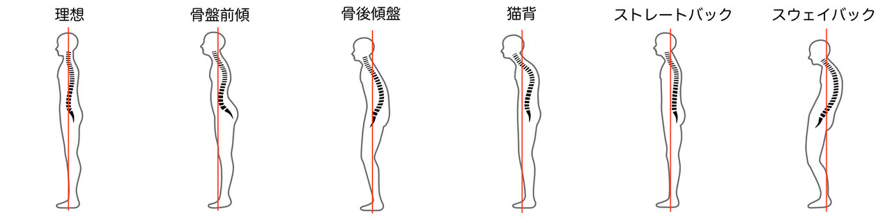 姿勢のタイプ